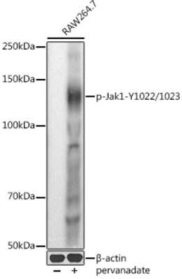 Western Blot: Jak1 [p Tyr1022, p Tyr1023] Antibody [NBP3-05436] - Western blot analysis of extracts of RAW264.7 cells, using Jak1 antibody (NBP3-05436) at 1:1000 dilution.RAW264.7 cells were treated by Pervanadate (1 mM) at 37C for 30 minutes. Secondary antibody: HRP Goat Anti-Rabbit IgG (H+L) at 1:10000 dilution. Lysates/proteins: 25ug per lane. Blocking buffer: 3% nonfat dry milk in TBST. Detection: ECL Basic Kit. Exposure time: 10s.